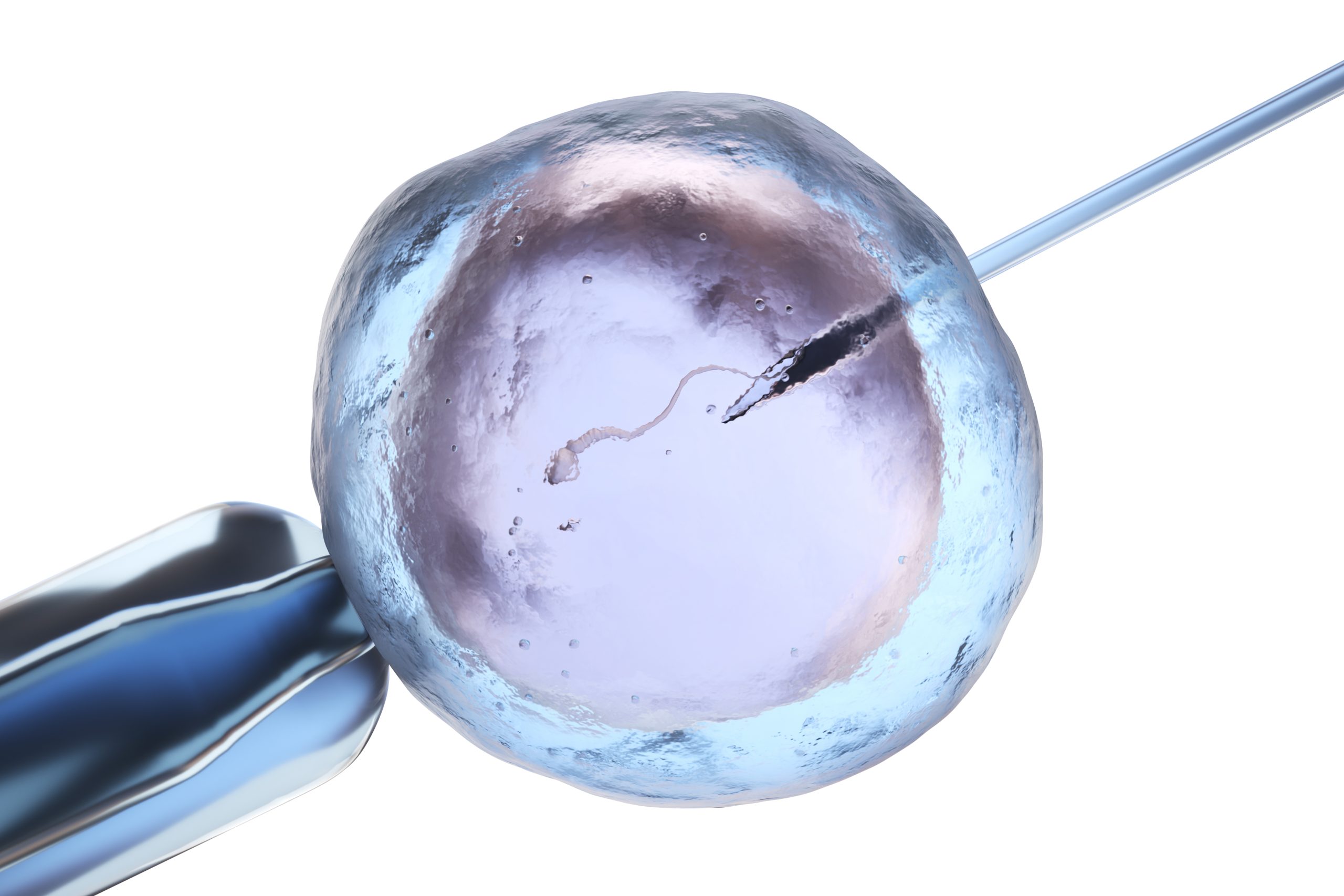IVF